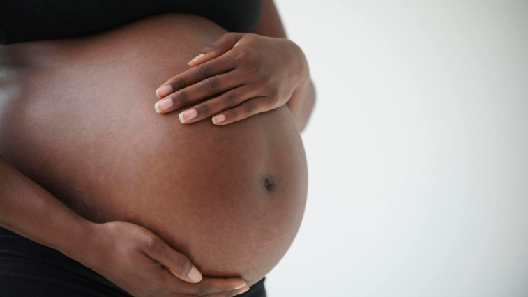 Concerned About Stretch Marks? Here Are Some Natural Ways to Prevent and Minimize Them